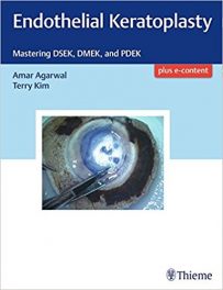 Book Review: Endothelial Keratoplasty – Mastering DSEK, DMEK, and PDEK