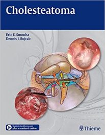 Book Review: Cholesteatoma