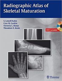 Book Review: Radiographic Atlas of Skeletal Maturation