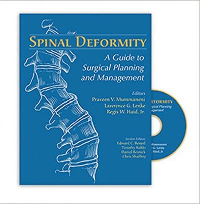 Book Review: Spinal Deformity – A Guide to Surgical Planning and Management