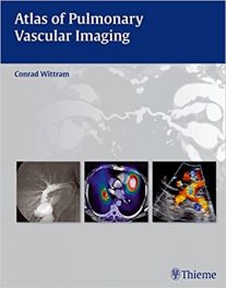 Book Review: Atlas of Pulmonary Vascular Imaging