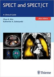 Book Review: SPECT and SPECT-CT – A Clinical Guide