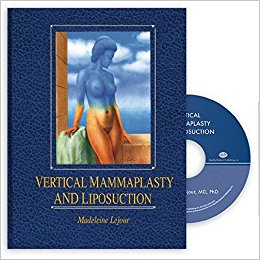 Book Review: Vertical Mammaplasty and Liposuction