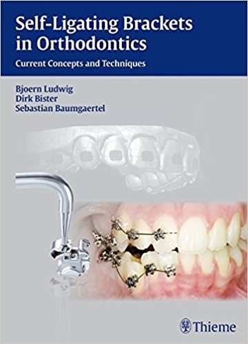 Book Review: Self-Ligating Brackets in Orthodontics