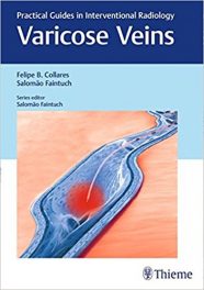 Book Review: Varicose Veins