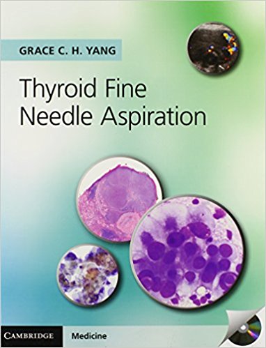 Book Review: Thyroid Fine Needle Aspiration