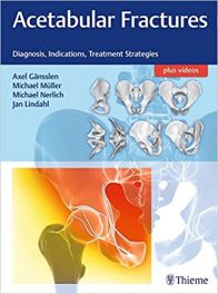 Book Review: Acetabular Fractures – Diagnosis, Indications, and Treatment Strategies