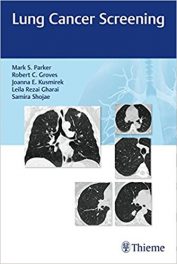 Book Review: Lung Cancer Screening