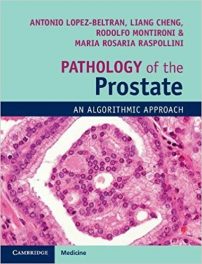 Book Review: Pathology of the Prostate – An Algorithmic Approach