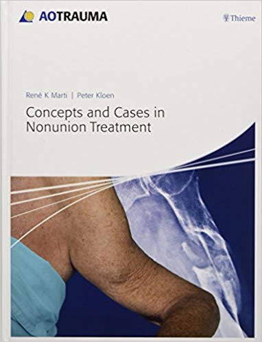 Book Review:  AO Trauma – Concepts and Cases in Nonunion Treatment
