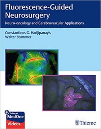 Book Review:  Fluorescense-Guided Neurosurgery – Neuro-oncology and Cerebrovascular Applications