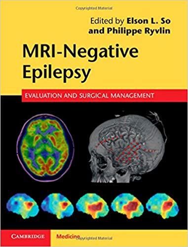 Book Review: MRI Negative Epilepsy – Evaluation and Surgical Management