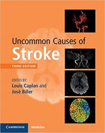 Book Review: Uncommon Causes of Stroke, 3rd edition