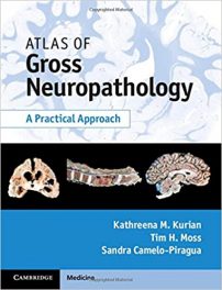 Book Review – Atlas of Gross Neuropathology – A Practical Approach