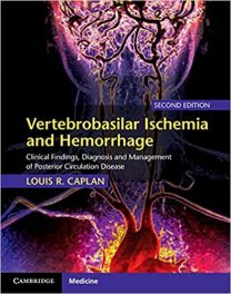 Book Review–Vertebrobasilar Ischemia and Hemorrhage – Clinical Findings, Diagnosis and Management of Posterior Circulation Disease, Second edition
